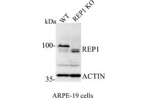 Western Blotting (WB) image for anti-Choroideremia (Rab Escort Protein 1) (CHM) (C-Term) antibody (ABIN6254221) (CHM antibody  (C-Term))