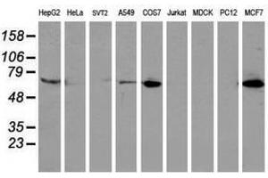 Image no. 3 for anti-Epsin 2 (EPN2) antibody (ABIN1498052) (Epsin 2 antibody)