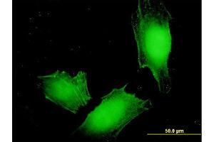 Immunofluorescence of monoclonal antibody to MAGEA4 on HeLa cell. (MAGEA4 antibody  (AA 98-171))