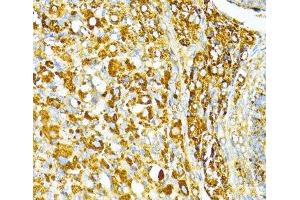 Immunohistochemistry of paraffin-embedded Rat ovary using VAMP1 Polyclonal Antibody at dilution of 1:100 (40x lens). (VAMP1 antibody)