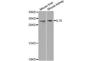 Western blot analysis of extracts of various cell lines, using IL10 antibody. (IL-10 antibody  (AA 19-178))