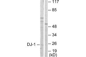 Western Blotting (WB) image for anti-Parkinson Protein 7 (PARK7) (Internal Region) antibody (ABIN1848506) (PARK7/DJ1 antibody  (Internal Region))
