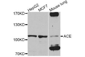 Western blot analysis of extracts of various cell lines, using ACE antibody. (Angiotensin I Converting Enzyme 1 antibody  (AA 30-270))