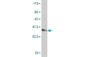 Western Blot detection against Immunogen (37. (Clathrin Heavy Chain (CLTC) (AA 232-340) antibody)