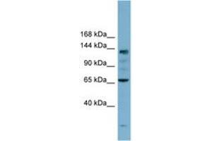Image no. 1 for anti-Isoleucyl-tRNA Synthetase (IARS) (AA 35-84) antibody (ABIN6741923) (IARS antibody  (AA 35-84))