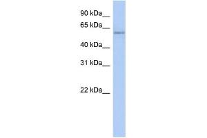 WB Suggested Anti-CPNE4 Antibody Titration: 0. (Copine IV antibody  (N-Term))