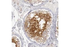Immunohistochemical staining of human breast with RIMBP3 polyclonal antibody  shows strong cytoplasmic positivity in cells in seminiferus ducts. (RIMBP3 antibody)