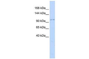 NEDD4 antibody used at 1 ug/ml to detect target protein.
