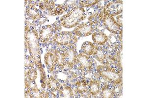 Immunohistochemistry of paraffin-embedded rat kidney using ANAPC5 antibody at dilution of 1:100 (x400 lens). (ANAPC5 antibody)