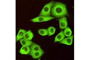 Immunocytochemistry of HeLa cells fixed by Paraformaldehyde and using DR5 mouse mAb diluted 1:100. (TNFRSF10B antibody)