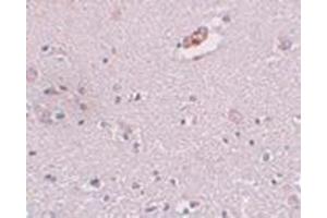 Immunohistochemistry of ZNF536 in human brain tissue with this product at 5 μg/ml.