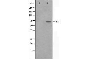 Western blot analysis on Jurkat cell lysate using p73 Antibody.