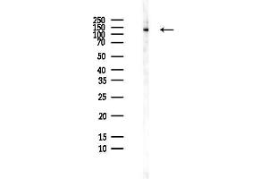 Western blot analysis of lysates from HepG2 cells(heat-shock,45 min treatment), using DGKD Antibody at 1/1000 dilution.