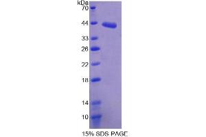 SDS-PAGE analysis of Mouse SDHC Protein. (SDHC Protein)