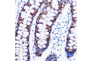 Immunohistochemistry of paraffin-embedded human colon using Monoamine Oxidase A (MAOA) (MAOA) Rabbit mAb (ABIN1682632, ABIN3018542, ABIN3018543 and ABIN7101625) at dilution of 1:100 (40x lens). (Monoamine Oxidase A antibody)