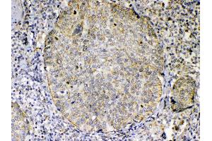 IHC analysis of TNFSF18 using anti-TNFSF18 antibody . (TNFSF18 antibody  (AA 70-199))