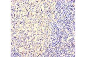 Immunohistochemistry of paraffin-embedded human tonsil tissue using ABIN7161144 at dilution of 1:100 (NEO1 antibody  (AA 414-682))