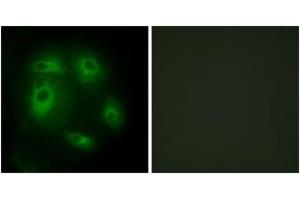 Immunofluorescence analysis of HeLa cells, using DLEC1 Antibody. (DLEC1 antibody  (AA 1-50))