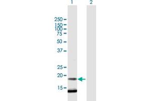 Western Blot analysis of C12orf65 expression in transfected 293T cell line by C12orf65 MaxPab polyclonal antibody. (C12orf65 antibody  (AA 1-166))