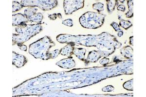 IHC analysis of FH using anti-FH antibody . (FH antibody)