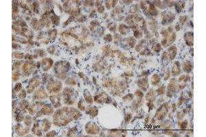 Image no. 1 for anti-Glycine N-Acyltransferase (GLYAT) (AA 64-164) antibody (ABIN599511) (GLYAT antibody  (AA 64-164))
