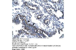 Human Lung (TAF7 antibody  (N-Term))
