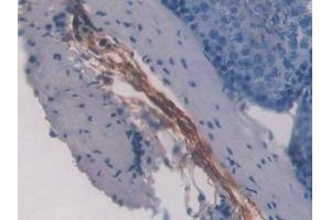 Immunohistochemistry (IHC) image for anti-Fibrillin 1 (FBN1) (AA 751-895) antibody (ABIN7432139)