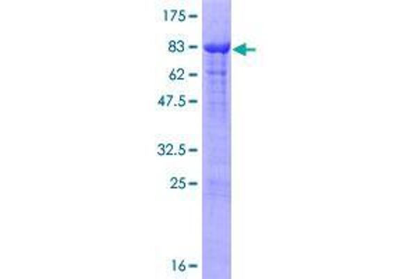RNF25 Protein (AA 1-459) (GST tag)