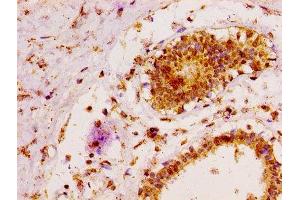 MAP3K6 antibody  (AA 905-990)