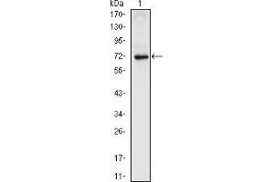 Western blot analysis using NKX2.