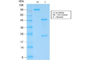 SDS-PAGE Analysis of Purified Kappa Light Chain Rabbit Recombinant Monoclonal (KLC2289R). (Recombinant IGKC antibody)