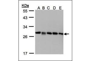 Sample (30 µg whole cell lysate). (GDI2 antibody)