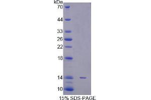 SDS-PAGE analysis of Human STAT5A Protein.