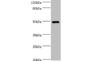 Western blot All lanes: HYAL1 antibody at 2 μg/mL + HepG2 whole cell lysate Secondary Goat polyclonal to rabbit IgG at 1/10000 dilution Predicted band size: 49, 46, 28, 24, 20, 11, 38 kDa Observed band size: 49 kDa