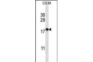 EIF5A2 Antibody (C-term) (ABIN657973 and ABIN2846919) western blot analysis in CEM cell line lysates (35 μg/lane). (EIF5A2 antibody  (C-Term))
