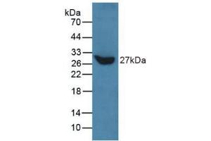 Western blot analysis of recombinant Human TLN. (Talin antibody  (AA 975-1181))