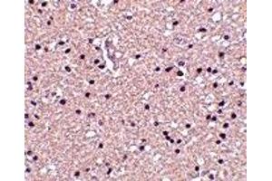 Immunohistochemistry (IHC) image for anti-Stathmin 1 (STMN1) (N-Term) antibody (ABIN1031495) (Stathmin 1 antibody  (N-Term))