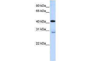 WB Suggested Anti-GRAMD2 Antibody Titration:  0. (GRAMD2 antibody  (Middle Region))