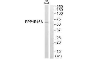 Western blot analysis of extracts from Rat heart cells, using PPP1R16A antibody. (PPP1R16A antibody)