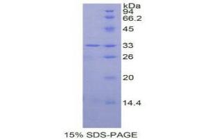 SDS-PAGE (SDS) image for Mitogen-Activated Protein Kinase 14 (MAPK14) (AA 19-279) protein (His tag) (ABIN1877644) (MAPK14 Protein (AA 19-279) (His tag))
