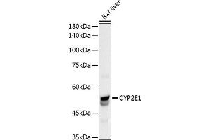 Western blot analysis of extracts of Rat liver, using CYP2E1 Rabbit pAb antibody (ABIN3023078, ABIN3023079, ABIN3023080 and ABIN6219379) at 1:1000 dilution.