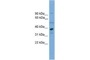WB Suggested Anti-APEX1 Antibody Titration: 0. (APEX1 antibody  (Middle Region))