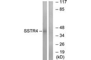 Western blot analysis of extracts from LOVO cells, using SSTR4 Antibody. (SSTR4 antibody  (AA 155-204))
