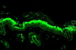 Nitrotyrosine (39B6), mouse backskin (Nitrotyrosine antibody)