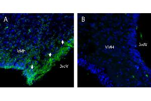 Free-floating frozen brain sections from a paraformaldehyde-perfused rat were incubated with Anti- (SLC7A1) (extracellular) Antibody (ABIN7885513, 1:300), followed by goat anti-rabbit secondary antibody conjugated to Alexa Fluor® 488 (green).