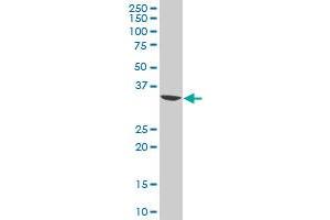 LZTFL1 polyclonal antibody (A01), Lot # 061130JCS1 Western Blot analysis of LZTFL1 expression in Jurkat . (LZTFL1 antibody  (AA 200-299))