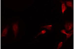ABIN6267640 staining Hela by IF/ICC. (eIF4EBP1 antibody  (pThr36))