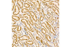 Immunohistochemistry of paraffin-embedded mouse kidney using Prohibitin Rabbit pAb (ABIN3020627, ABIN3020628, ABIN3020629 and ABIN6213601) at dilution of 1:25 (40x lens).