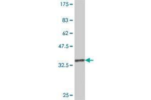 Western Blot detection against Immunogen (37. (RAB7B antibody  (AA 100-199))