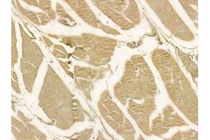 ABIN6256857 and ABIN6273593 at 1/100 staining human tongue carcinoma by IHC-P.